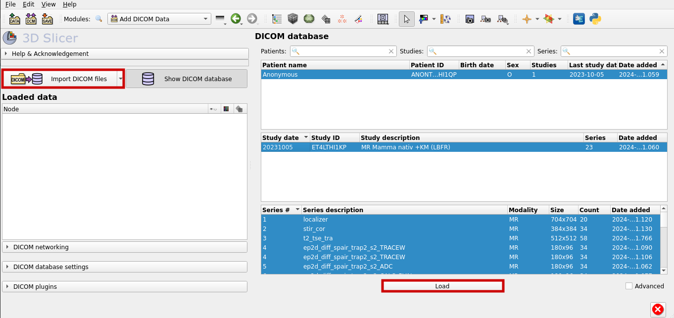 Import DICOM File and Load It