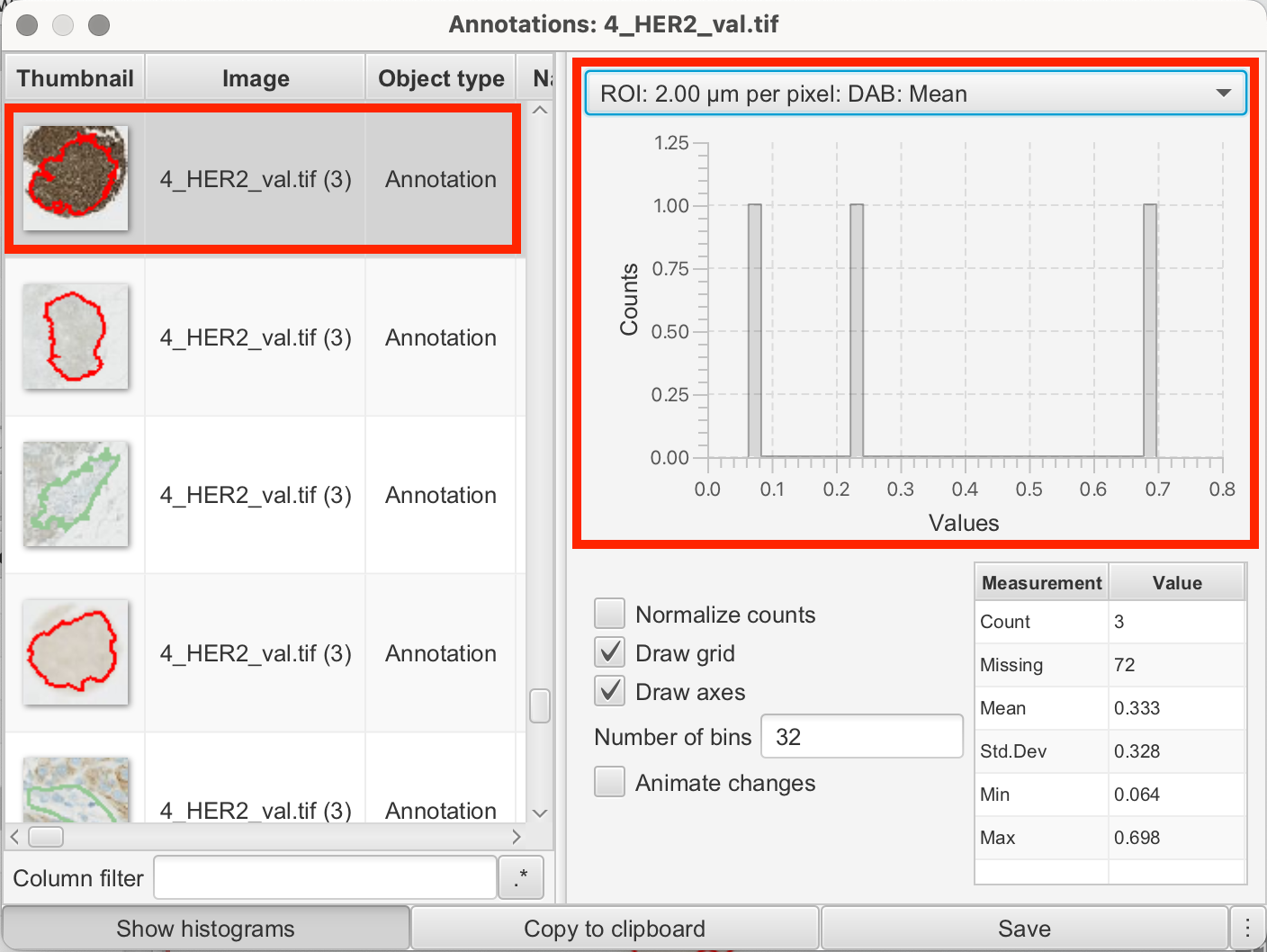Histogram of DAB mean