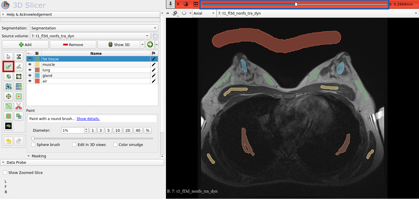 Create the Seeds of the Segments