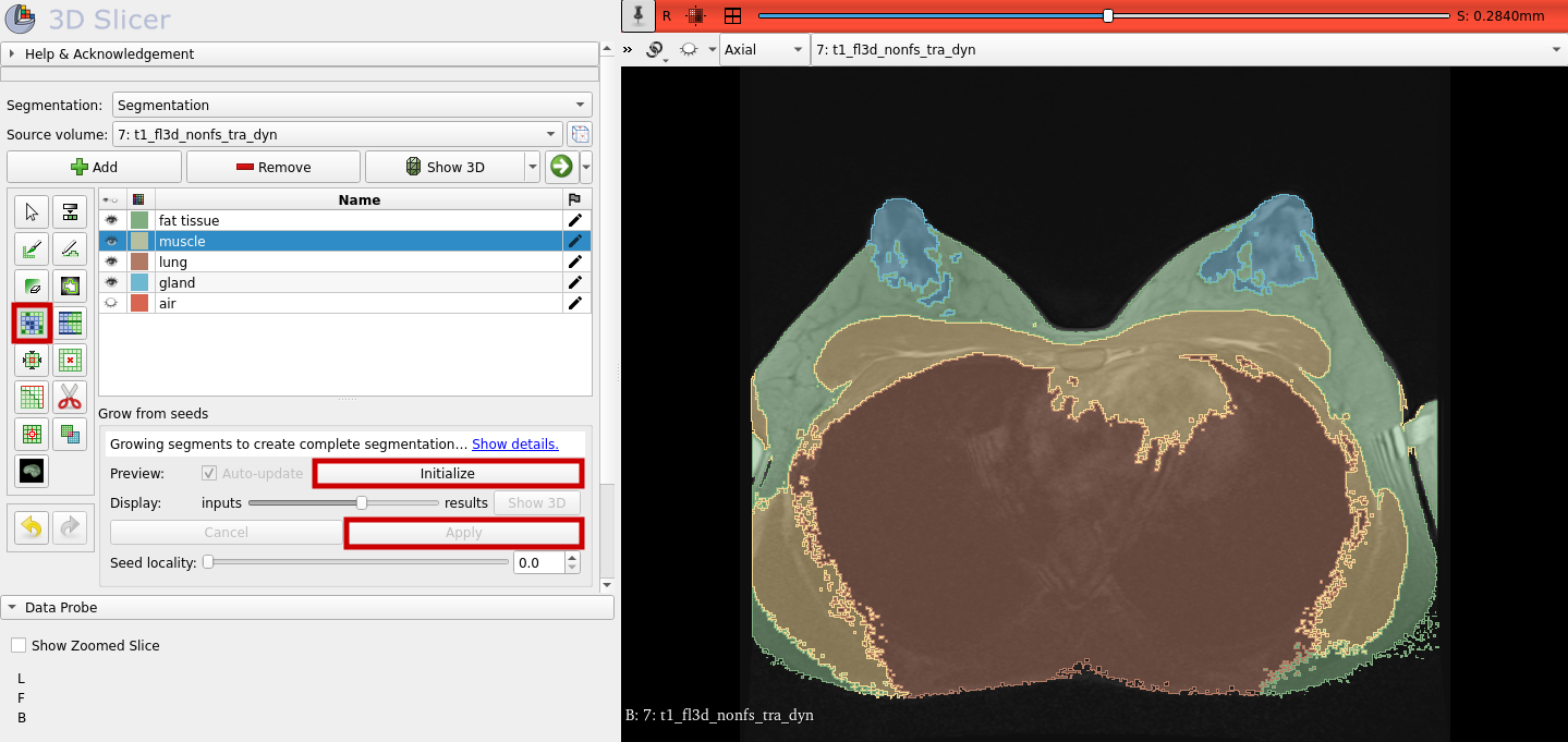 Grow the segments from the seeds