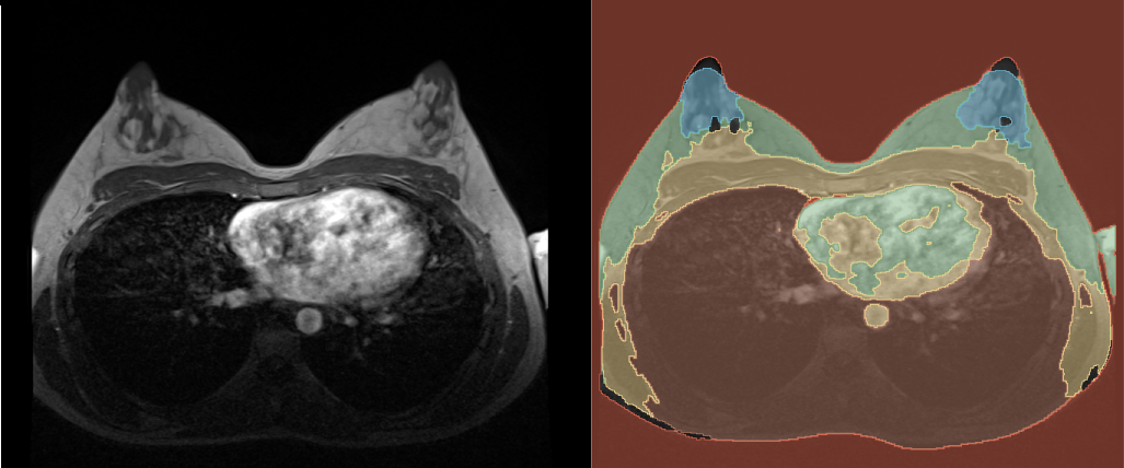 Predicted segmentation. Left: reference volume, right: segmentation
