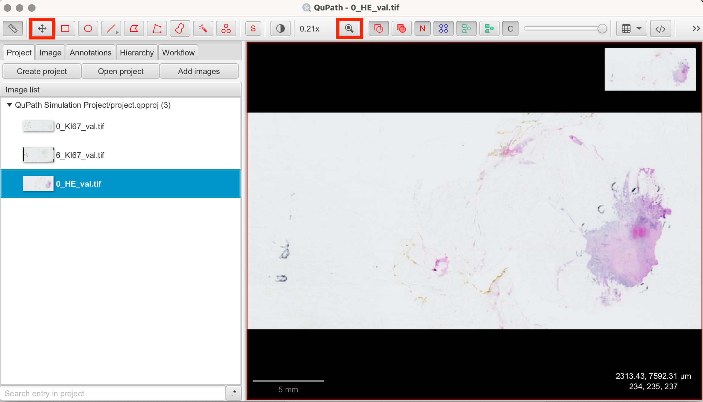 Navigating within the image