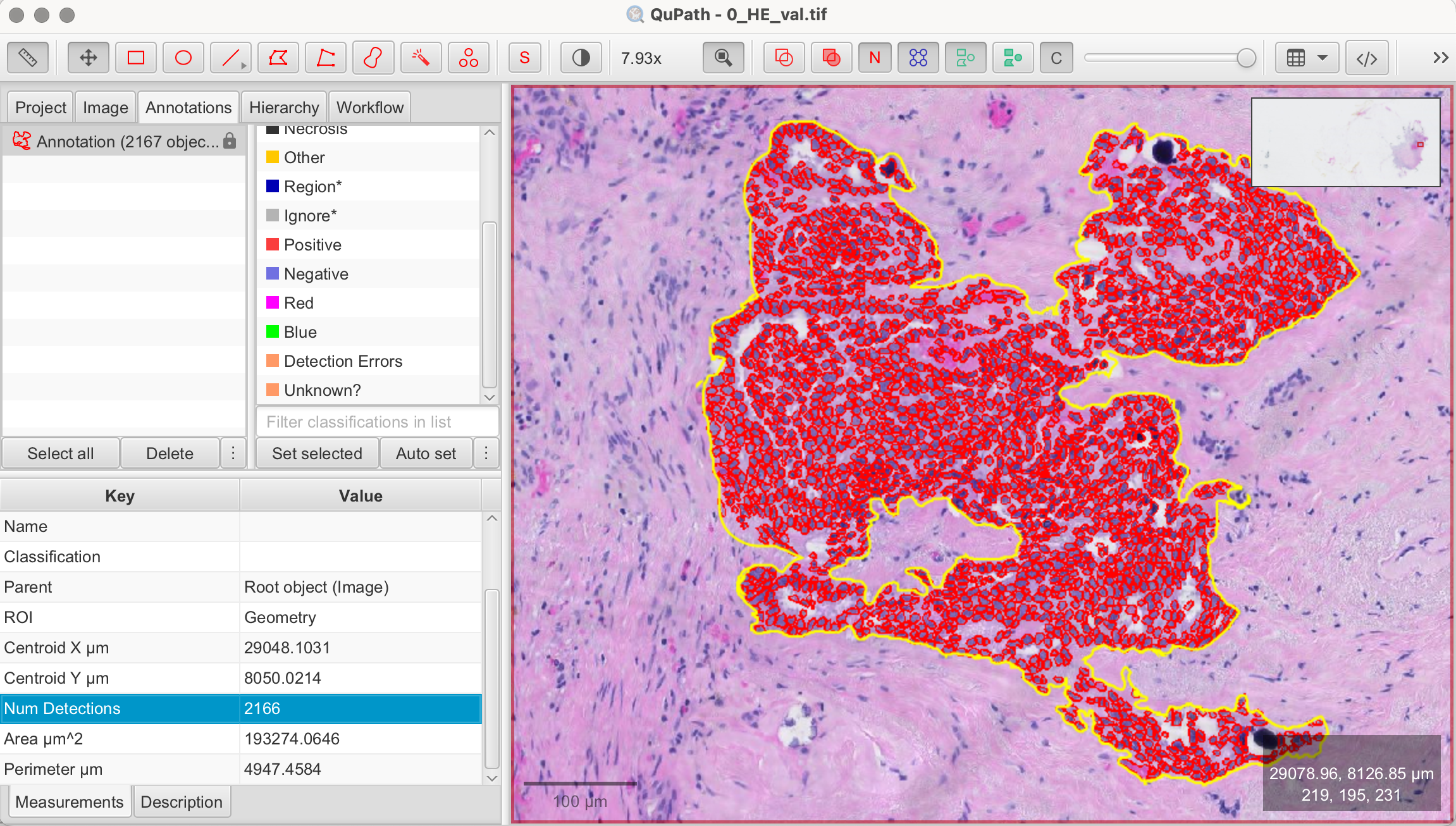 Check cell detection number
