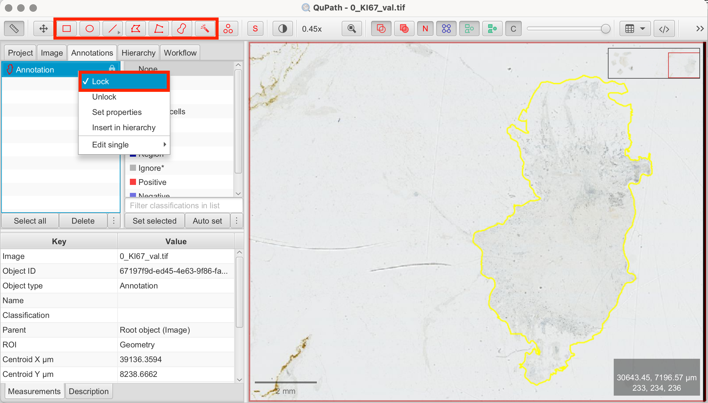Draw tissue annotation