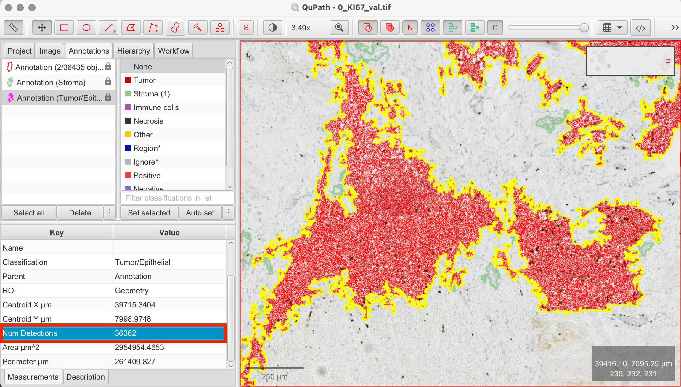 Cell detection results