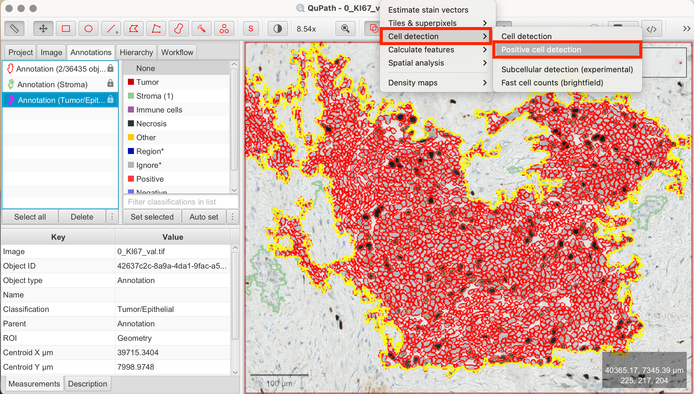 Open positive cell detection