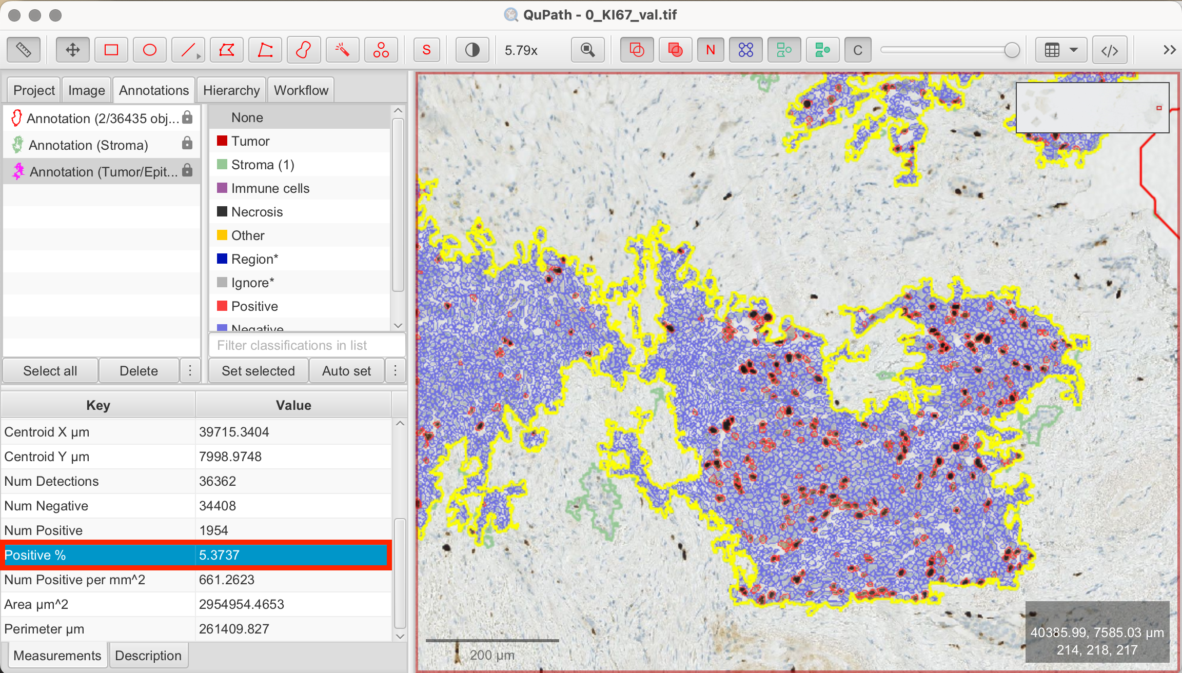 Positive cell detection results